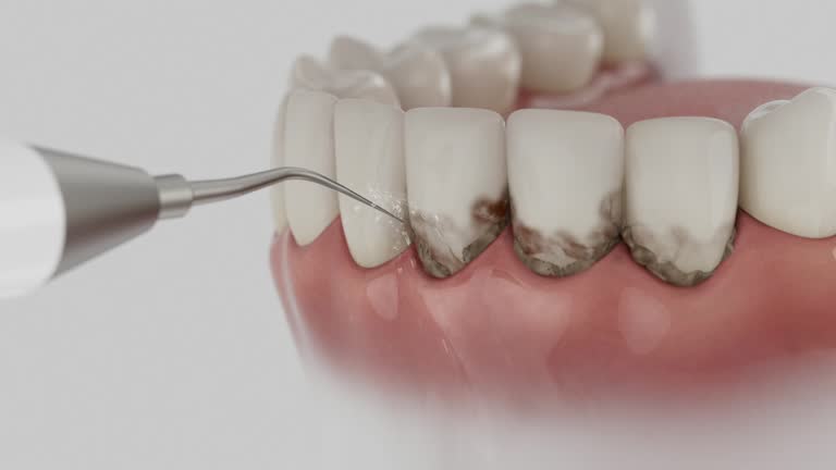 Trusted Tooth Extraction service in Bowling Green, FL - Dentist Open Now